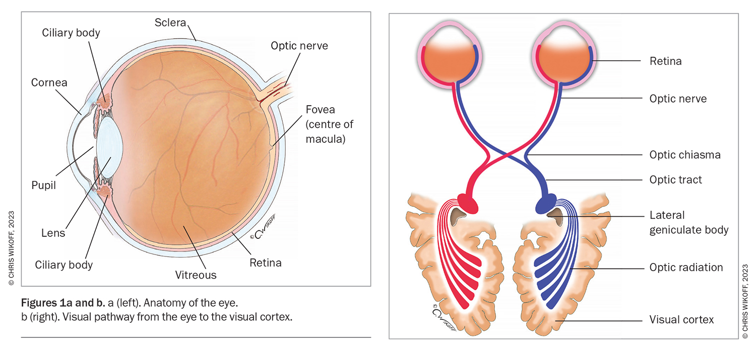 Flashes and floaters symptoms not to be ignored Medicine Today